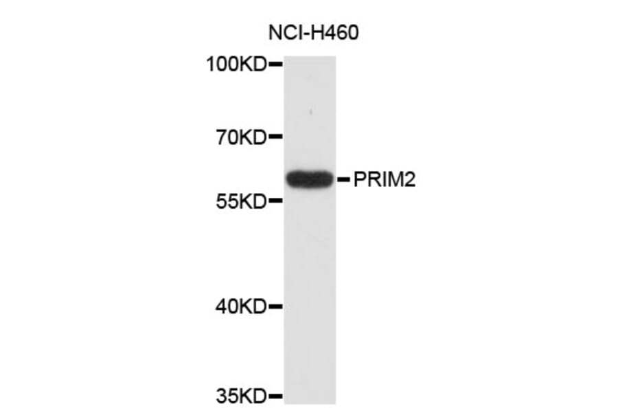 Western Blot - Anti-PRIM2 Antibody (A4041) - Antibodies.com