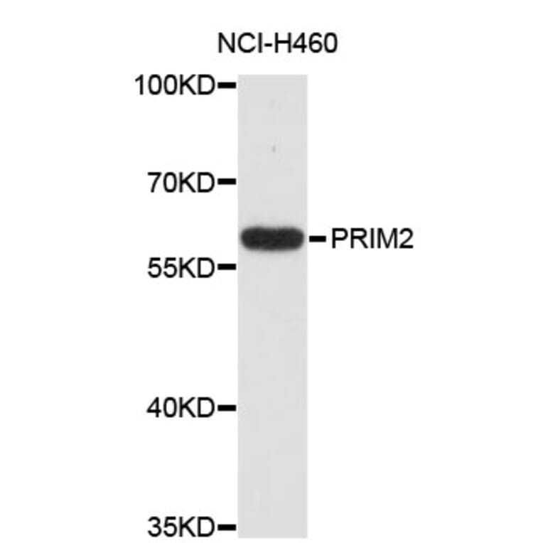 Western Blot - Anti-PRIM2 Antibody (A4041) - Antibodies.com
