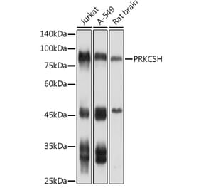 Western Blot - Anti-Glucosidase 2 subunit beta Antibody (A9360) - Antibodies.com