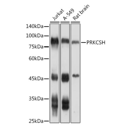 Western Blot - Anti-Glucosidase 2 subunit beta Antibody (A9360) - Antibodies.com