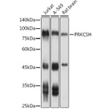 Western Blot - Anti-Glucosidase 2 subunit beta Antibody (A9360) - Antibodies.com