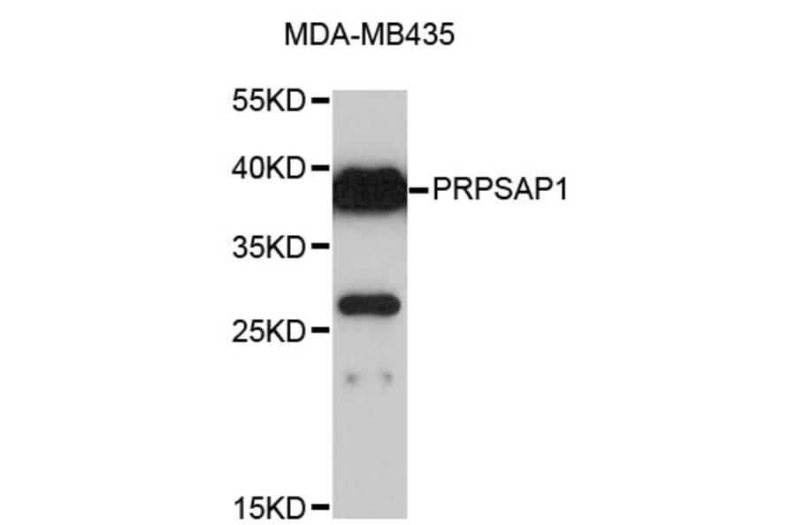 Western Blot - Anti-PRPSAP1 Antibody (A4049) - Antibodies.com
