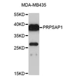 Western Blot - Anti-PRPSAP1 Antibody (A4049) - Antibodies.com