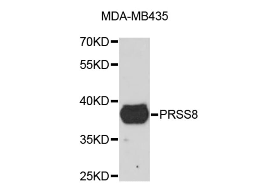Western Blot - Anti-PRSS8 Antibody (A4051) - Antibodies.com