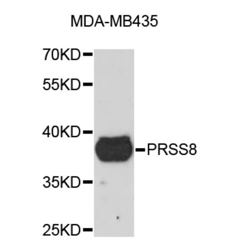 Western Blot - Anti-PRSS8 Antibody (A4051) - Antibodies.com