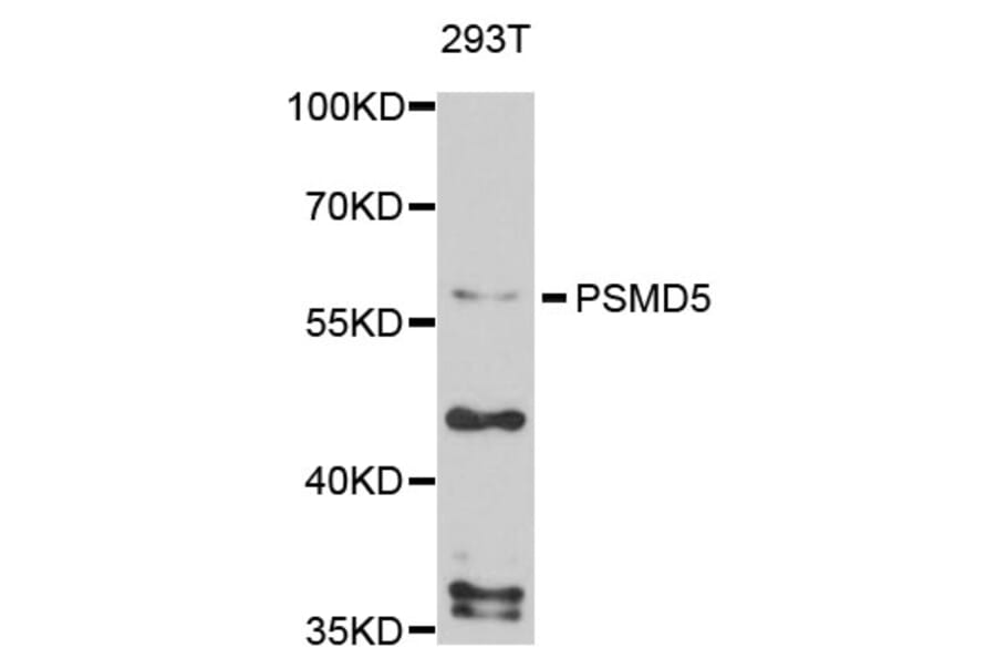 Western Blot - Anti-PSMD5 Antibody (A4056) - Antibodies.com