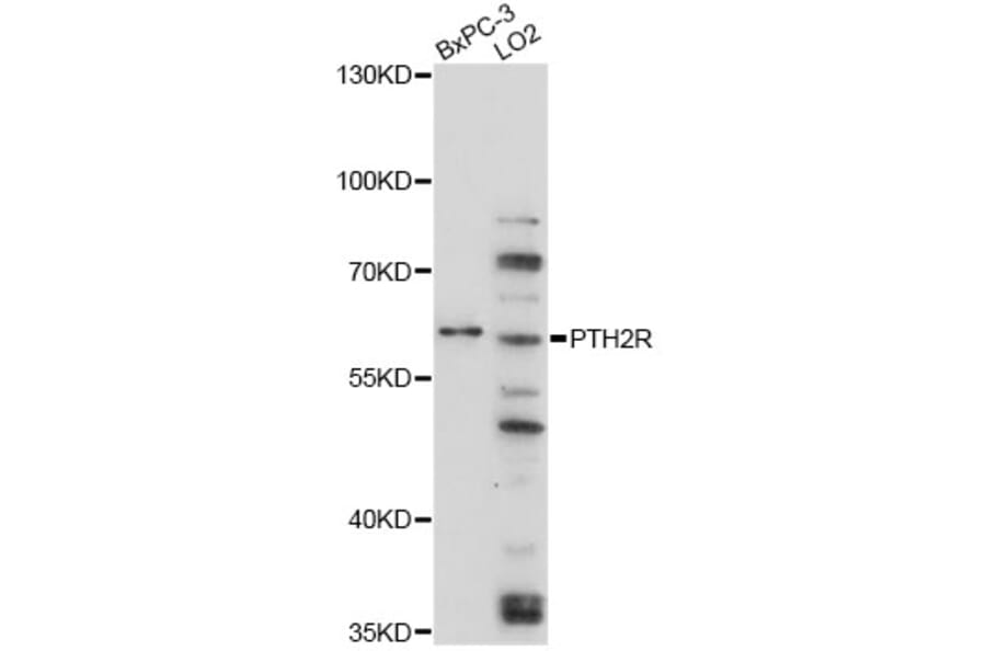Western Blot - Anti-PTH2R Antibody (A4058) - Antibodies.com