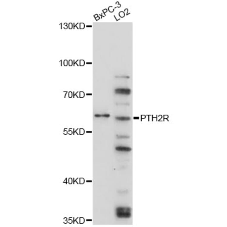 Western Blot - Anti-PTH2R Antibody (A4058) - Antibodies.com