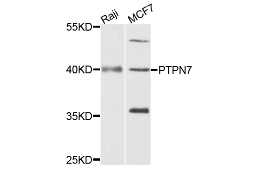 Western Blot - Anti-PTPN7 Antibody (A4062) - Antibodies.com
