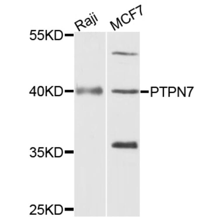 Western Blot - Anti-PTPN7 Antibody (A4062) - Antibodies.com