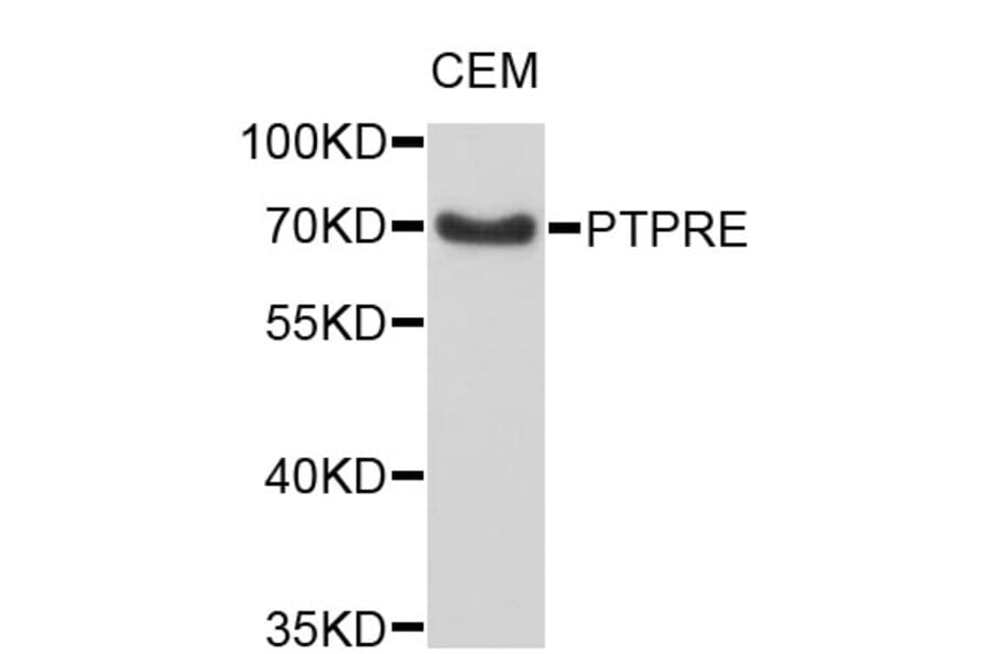 Western Blot - Anti-PTPRE Antibody (A4063) - Antibodies.com