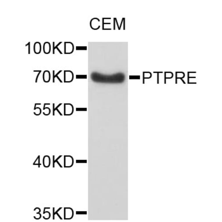 Western Blot - Anti-PTPRE Antibody (A4063) - Antibodies.com