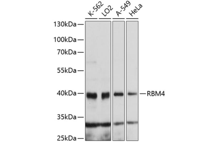 Western Blot - Anti-RBM4 Antibody (A4073) - Antibodies.com