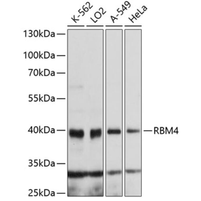 Western Blot - Anti-RBM4 Antibody (A4073) - Antibodies.com