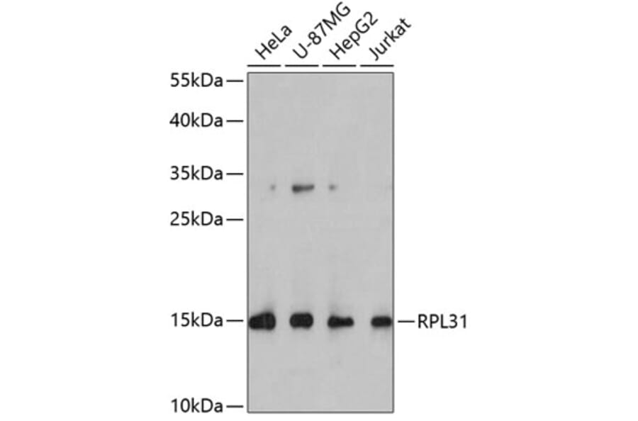 Western Blot - Anti-RPL31 Antibody (A4089) - Antibodies.com