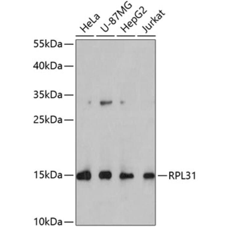 Western Blot - Anti-RPL31 Antibody (A4089) - Antibodies.com