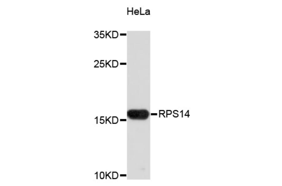 Western Blot - Anti-RPS14 Antibody (A4094) - Antibodies.com