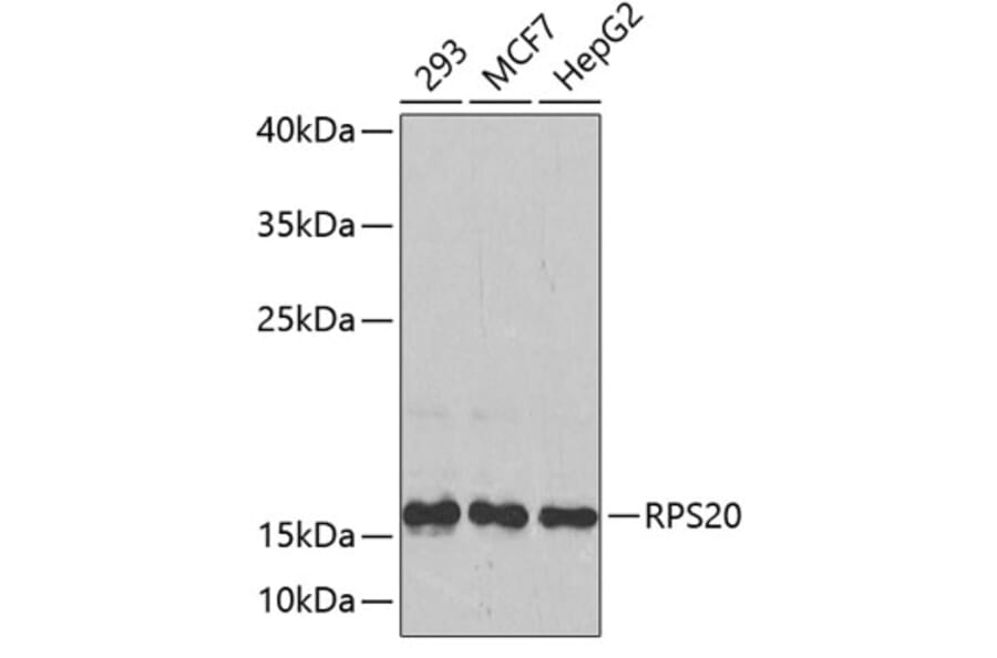 Western Blot - Anti-RPS20 Antibody (A4096) - Antibodies.com