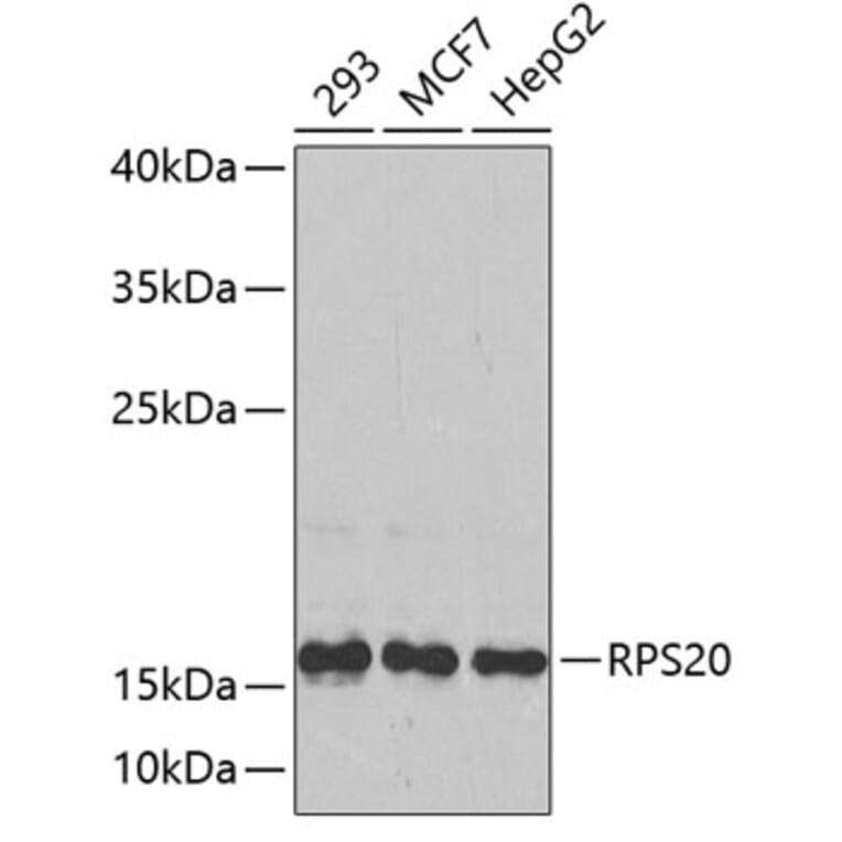 Western Blot - Anti-RPS20 Antibody (A4096) - Antibodies.com