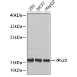 Western Blot - Anti-RPS20 Antibody (A4096) - Antibodies.com