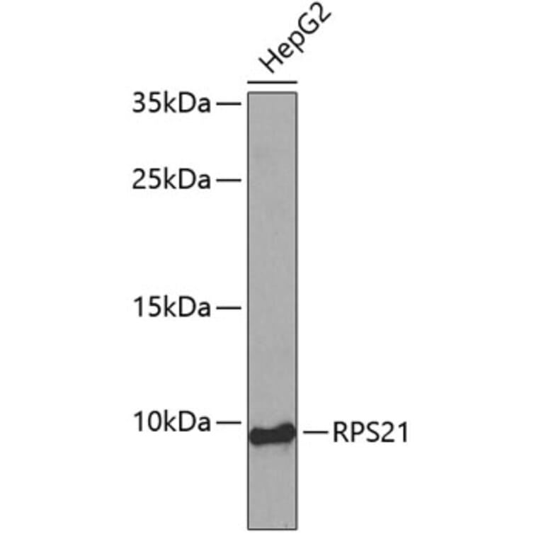 Western Blot - Anti-RPS21 Antibody (A4097) - Antibodies.com