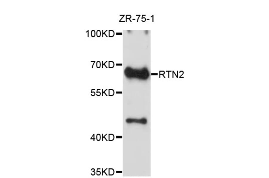 Western Blot - Anti-RTN2 Antibody (A4100) - Antibodies.com