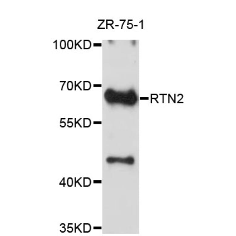 Western Blot - Anti-RTN2 Antibody (A4100) - Antibodies.com