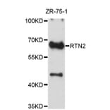 Western Blot - Anti-RTN2 Antibody (A4100) - Antibodies.com