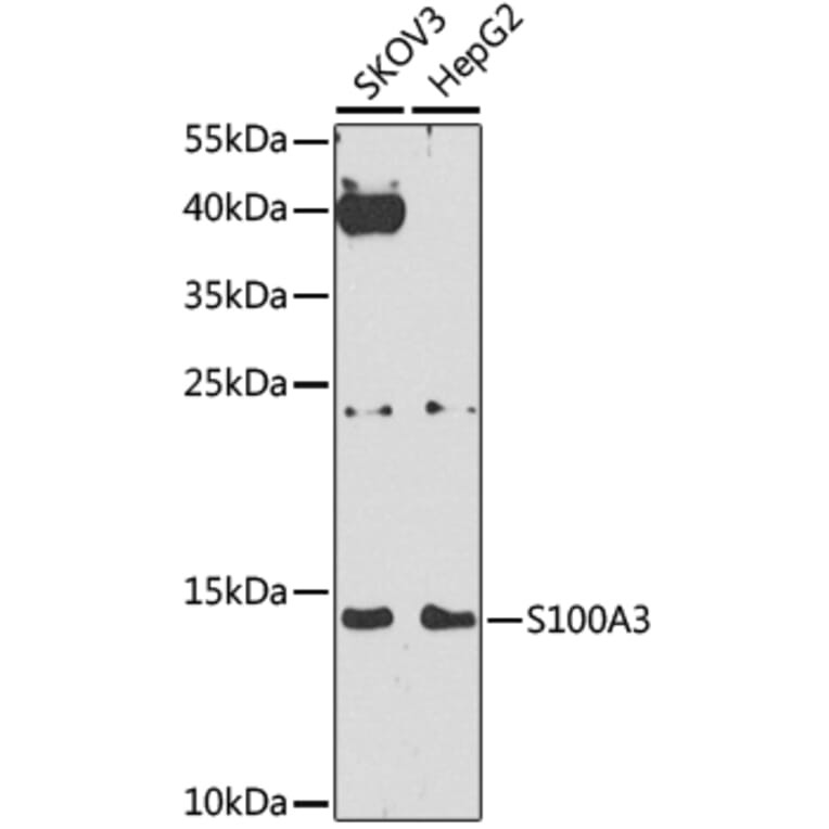 Western Blot - Anti-S100A3 Antibody (A9378) - Antibodies.com