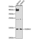 Western Blot - Anti-S100A3 Antibody (A9378) - Antibodies.com