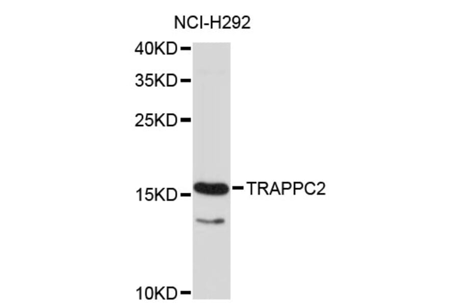 Western Blot - Anti-TRAPPC2 Antibody (A4107) - Antibodies.com