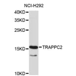 Western Blot - Anti-TRAPPC2 Antibody (A4107) - Antibodies.com