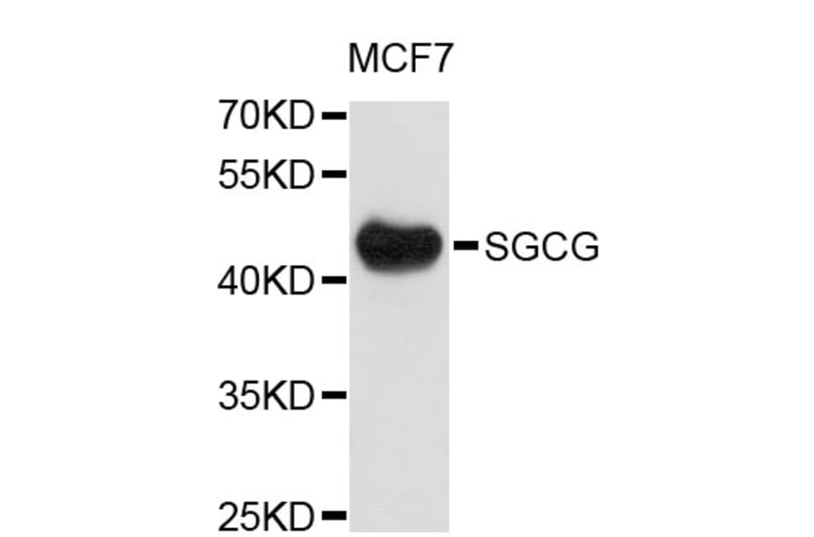 Western Blot - Anti-SGCG Antibody (A4110) - Antibodies.com