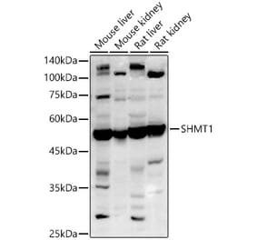 Western Blot - Anti-SHMT1 Antibody (A9381) - Antibodies.com