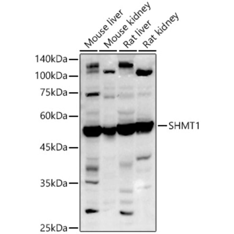 Western Blot - Anti-SHMT1 Antibody (A9381) - Antibodies.com