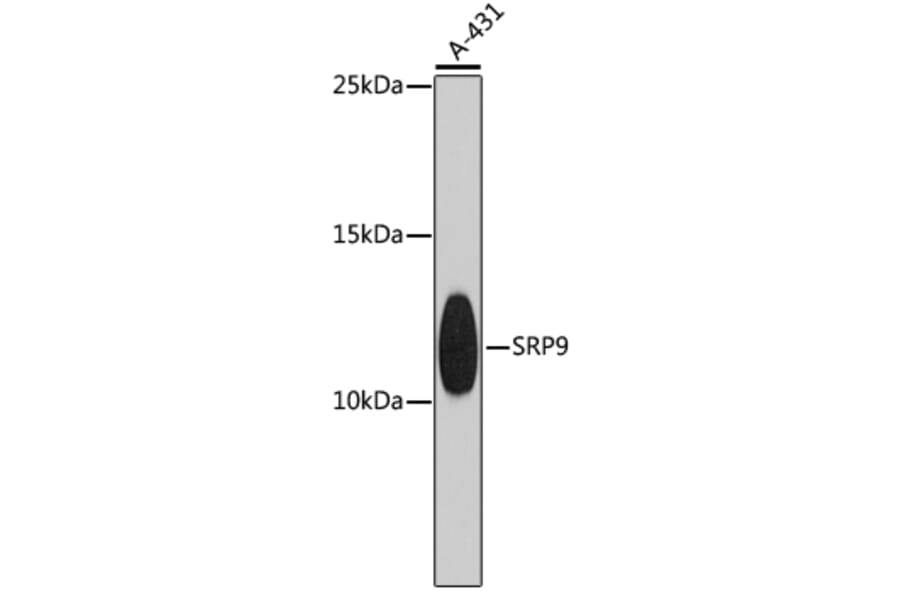 Western Blot - Anti-SRP9 Antibody (A9383) - Antibodies.com