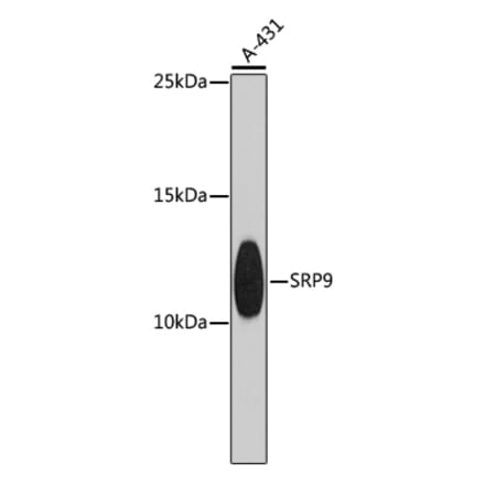 Western Blot - Anti-SRP9 Antibody (A9383) - Antibodies.com