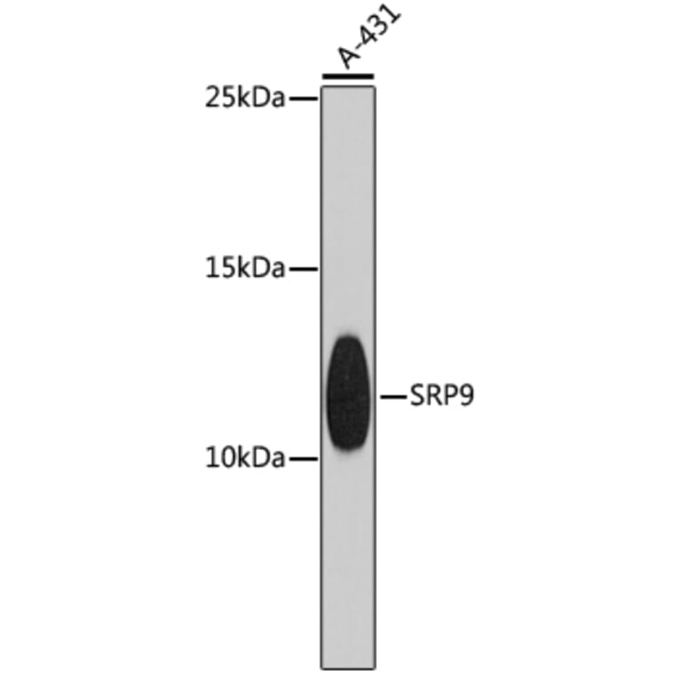 Western Blot - Anti-SRP9 Antibody (A9383) - Antibodies.com