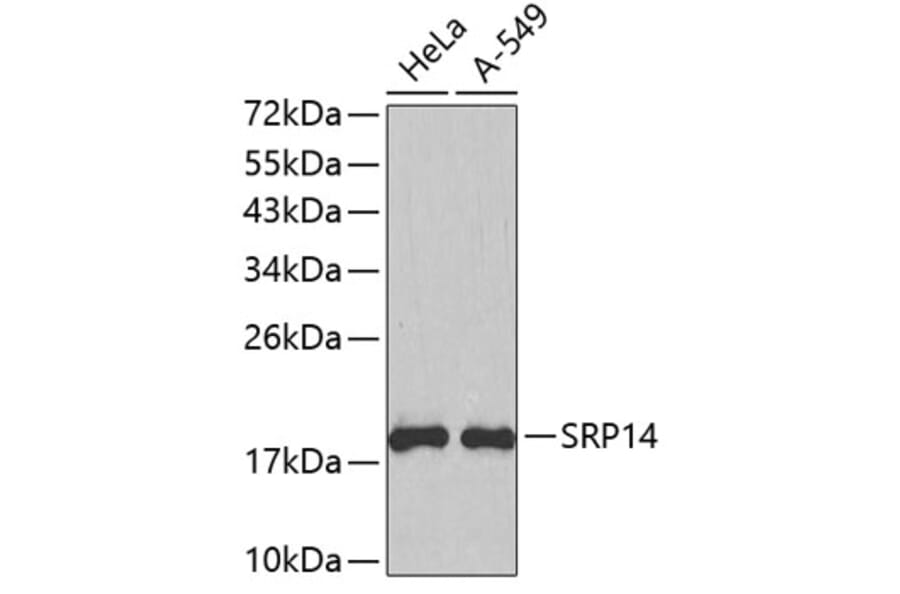 Western Blot - Anti-SRP14 Antibody (A4125) - Antibodies.com