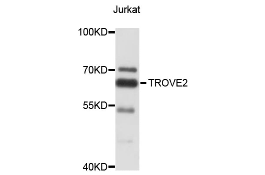 Western Blot - Anti-TROVE2 Antibody (A4128) - Antibodies.com