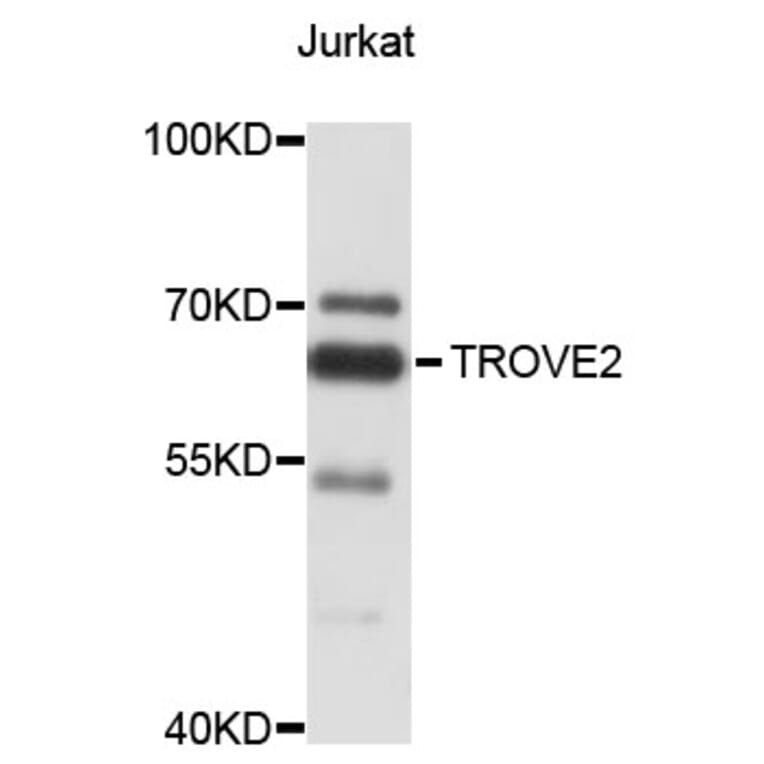 Western Blot - Anti-TROVE2 Antibody (A4128) - Antibodies.com