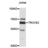 Western Blot - Anti-TROVE2 Antibody (A4128) - Antibodies.com