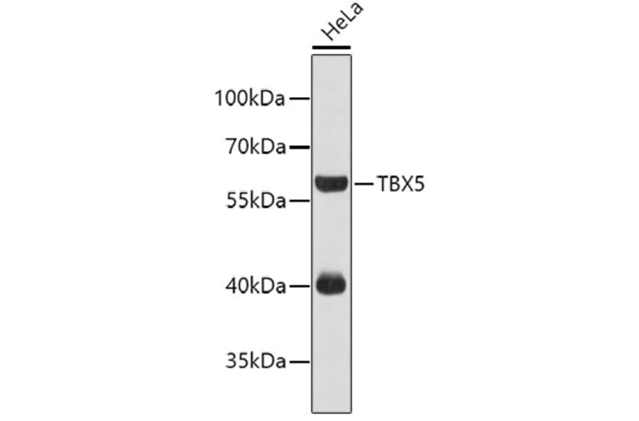 Western Blot - Anti-TBX5 Antibody (A4141) - Antibodies.com