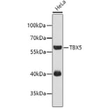 Western Blot - Anti-TBX5 Antibody (A4141) - Antibodies.com