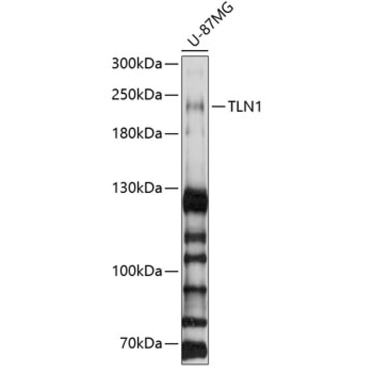 Western Blot - Anti-Talin 1 Antibody (A9389) - Antibodies.com