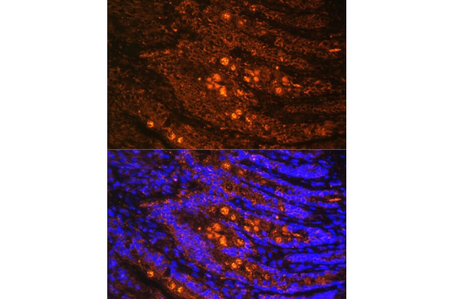 Immunofluorescence - Anti-Talin 1 Antibody (A9389) - Antibodies.com