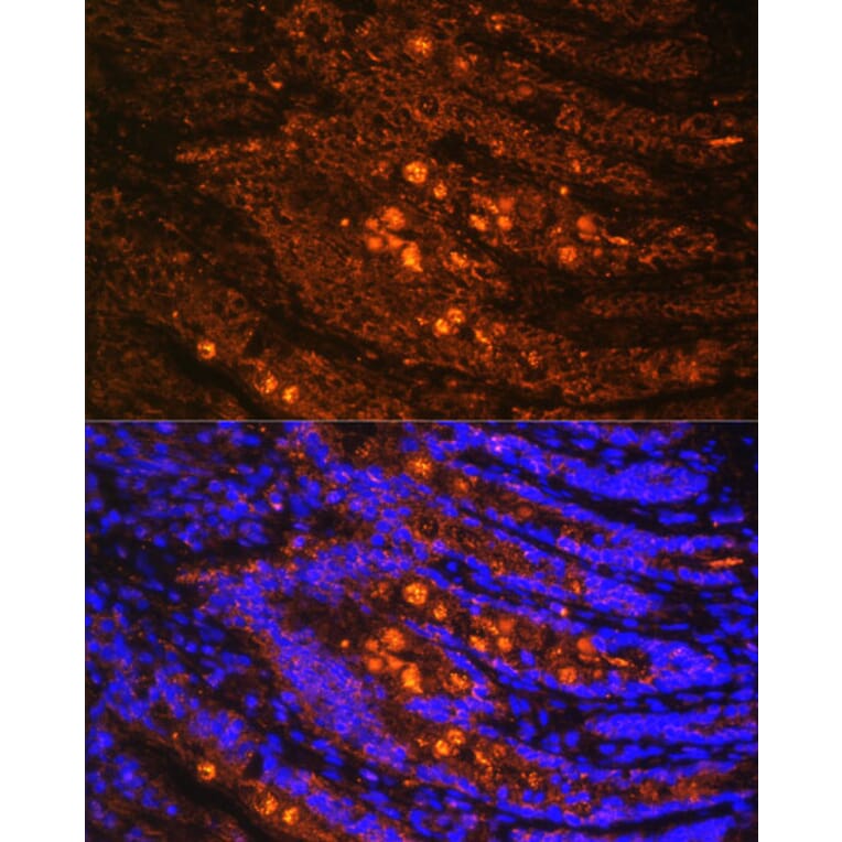 Immunofluorescence - Anti-Talin 1 Antibody (A9389) - Antibodies.com