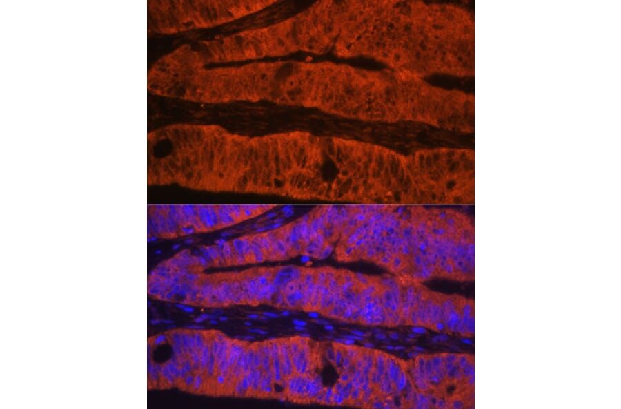 Immunofluorescence - Anti-Talin 1 Antibody (A9389) - Antibodies.com