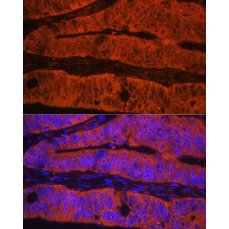 Immunofluorescence - Anti-Talin 1 Antibody (A9389) - Antibodies.com