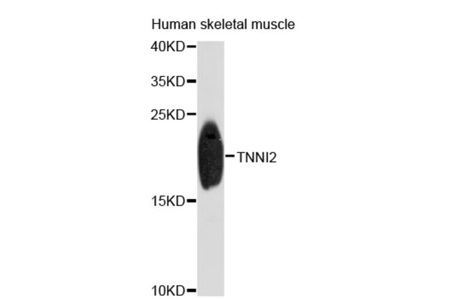 Western Blot - Anti-TNNI2 Antibody (A4162) - Antibodies.com